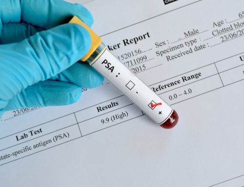 Change in guidance over PSA testing
